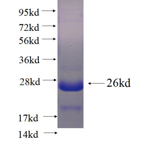 Recombinant human ZMAT5 SDS-PAGE