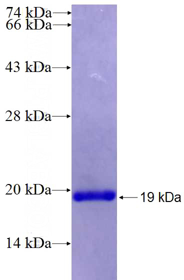 Recombinant Human PDXP SDS-PAGE