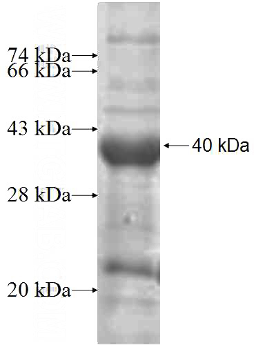 Recombinant Human INPP5B SDS-PAGE