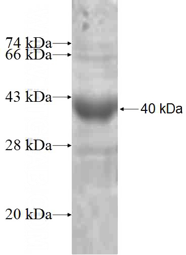 Recombinant Human VIPR1 SDS-PAGE