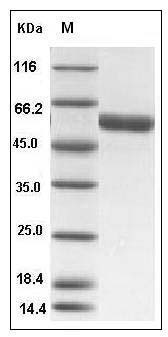 Human TRP1 / TYRP1 Protein (His Tag) SDS-PAGE