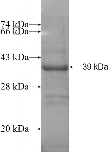 Recombinant Human C21orf59 SDS-PAGE