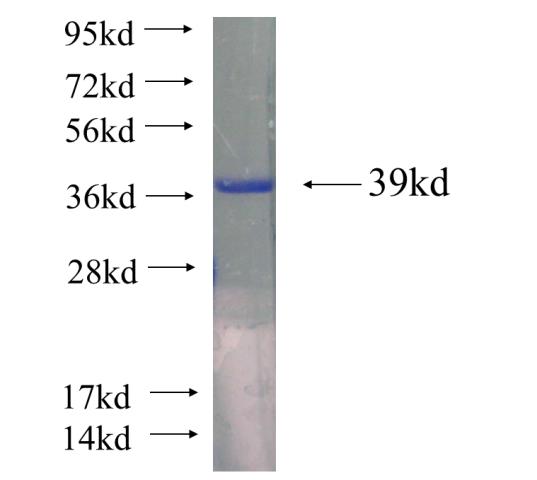 Recombinant human PDZK1 SDS-PAGE