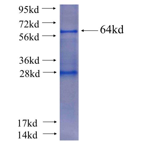 Recombinant human SGSM3 SDS-PAGE