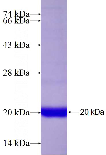 Recombinant Human RHEB SDS-PAGE