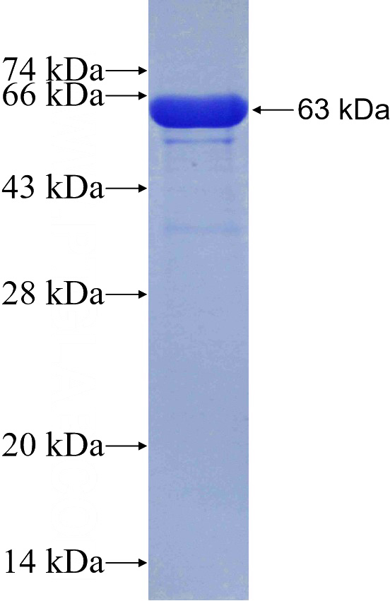 Recombinant Human TPM2 SDS-PAGE