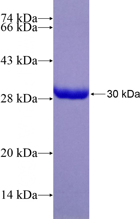 Recombinant Human PGAM1 SDS-PAGE