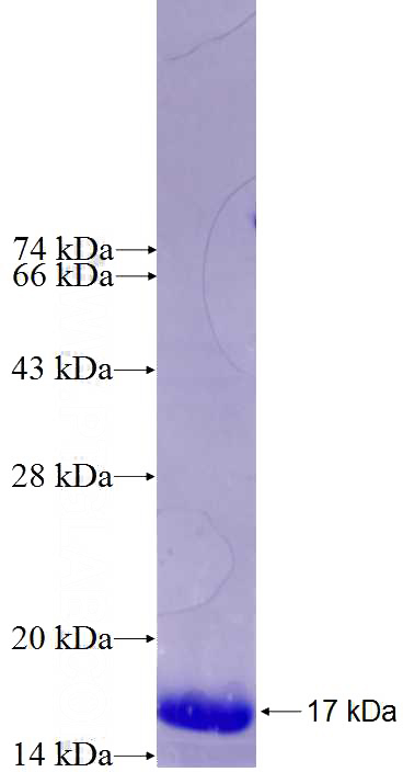 Recombinant Human CCDC90B SDS-PAGE