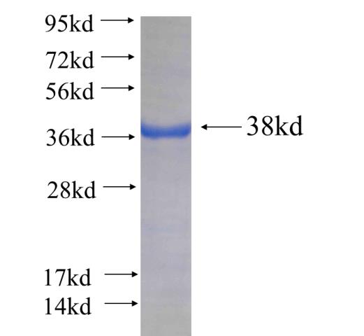 Recombinant human F12 SDS-PAGE