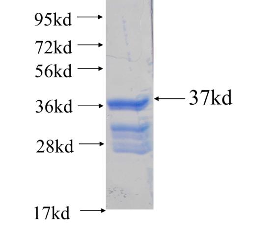 Recombinant human ZDHHC15 SDS-PAGE