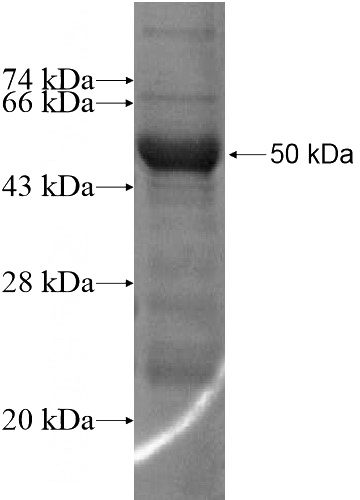 Recombinant Human HDHD3 SDS-PAGE