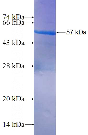 Recombinant Human SH3BGR SDS-PAGE