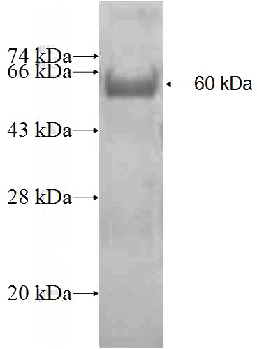 Recombinant Human UBR4 SDS-PAGE