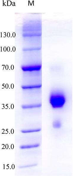 Human RGMA Protein (His Tag) SDS-PAGE