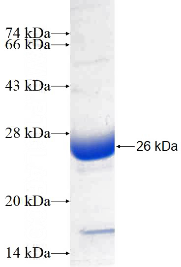 Recombinant Human ANKRD23 SDS-PAGE