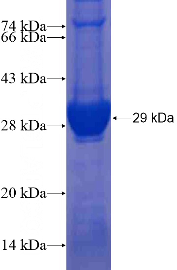 Recombinant Human RAB32 SDS-PAGE