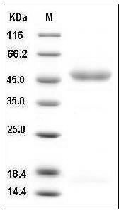 Human IL11RA / IL11R? Protein (His Tag) SDS-PAGE