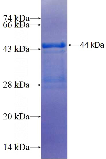 Recombinant Human ZNF367 SDS-PAGE
