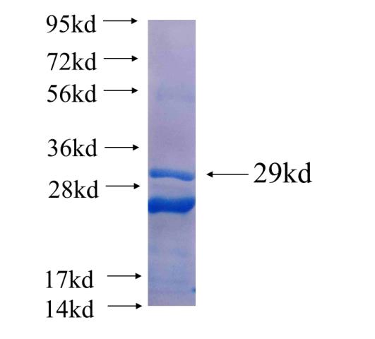 Recombinant human MFI2 SDS-PAGE