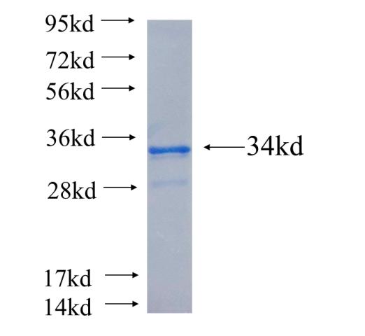 Recombinant human PRKCZ SDS-PAGE
