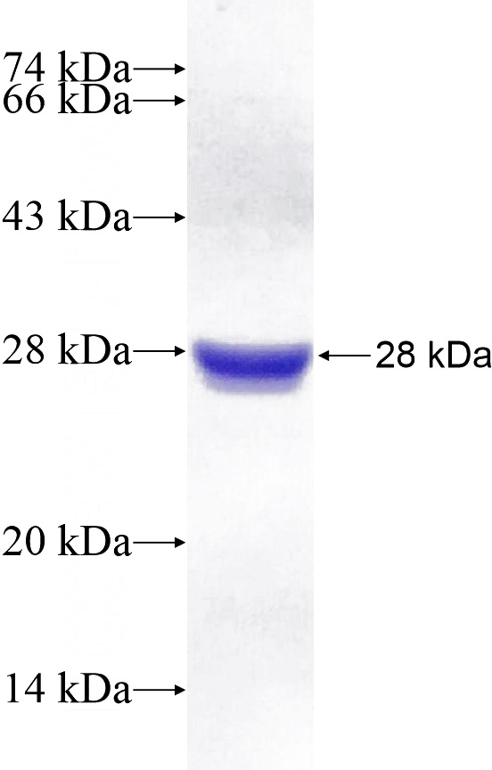 Recombinant Human SKI SDS-PAGE