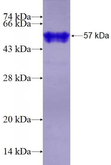 Recombinant Human HNRNPA0 SDS-PAGE