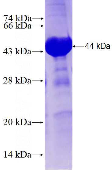 Recombinant Human FBXO30 SDS-PAGE