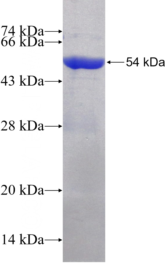 Recombinant Human SPAG16 SDS-PAGE