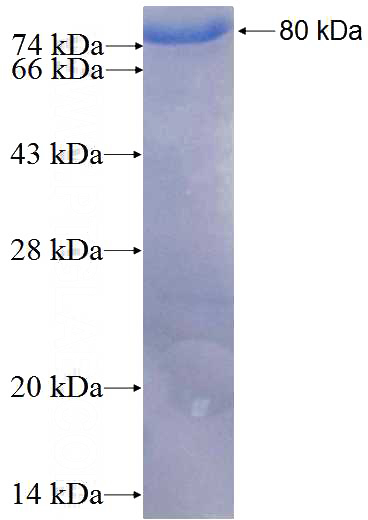 Recombinant Human STK3 SDS-PAGE