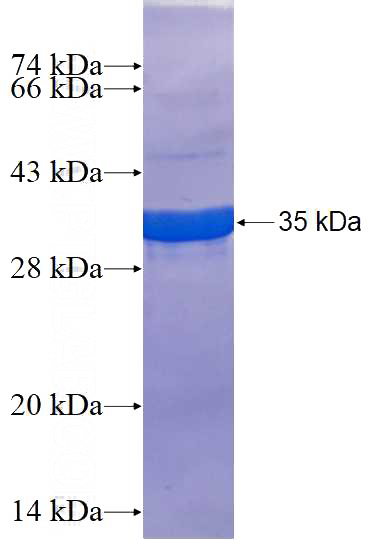 Recombinant Human CXorf15 SDS-PAGE