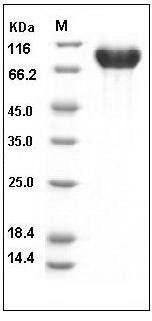 Human PIGR Protein (365 Ser/Gly, His Tag) SDS-PAGE