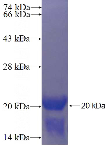 Recombinant Human MYO1F SDS-PAGE