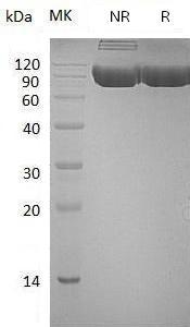 Human PIGR (His tag) recombinant protein