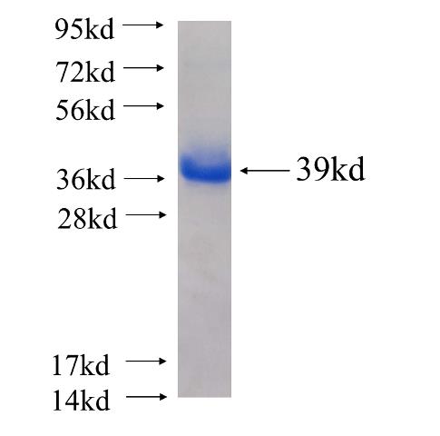 Recombinant human SHCBP1 SDS-PAGE