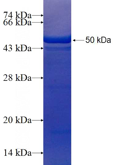 Recombinant Human TARA SDS-PAGE