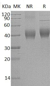 Human IL22RA2/UNQ5793/PRO19598/PRO19822 (His tag) recombinant protein