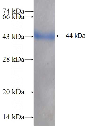 Recombinant Human CARS SDS-PAGE