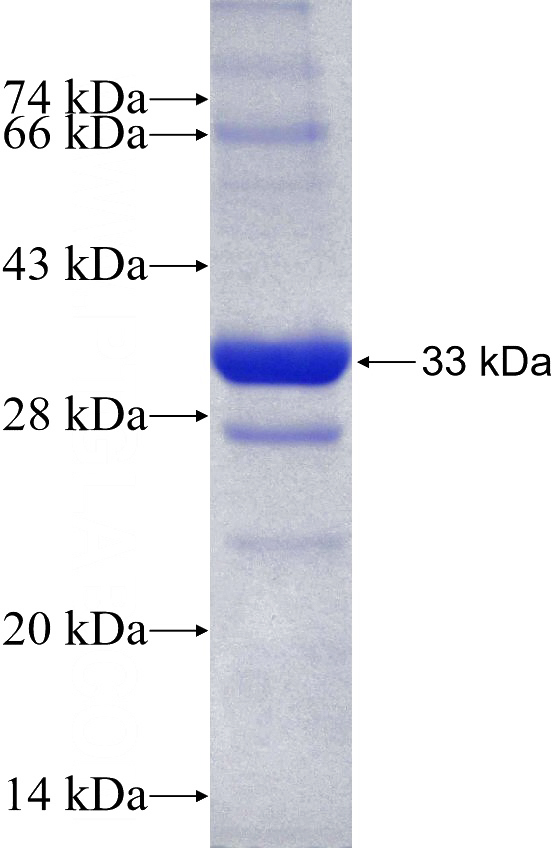 Recombinant Human SNAP29 SDS-PAGE