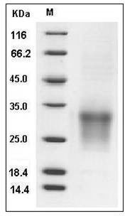 Human CD82 / KAI-1 Protein (His Tag) SDS-PAGE