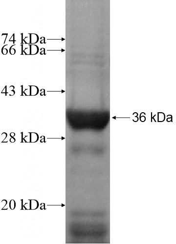 Recombinant Human NCOA5 SDS-PAGE