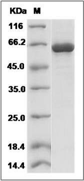 Human EphA2 Protein (aa 585-976, His & GST Tag) SDS-PAGE