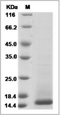 CST3 protein SDS-PAGE