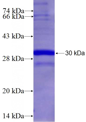 Recombinant Human AOC2 SDS-PAGE