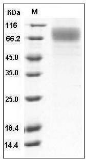 Human SCARB1 / CD36L1 / CLA-1 Protein (His Tag) SDS-PAGE