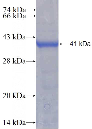 Recombinant Human RASSF4 SDS-PAGE