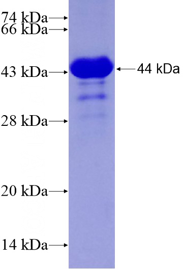 Recombinant Human MUS81 SDS-PAGE