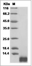 Mouse NAP-2 / PPBP / CXCL7 Protein (aa 49-109, His Tag) SDS-PAGE