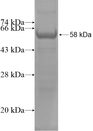 Recombinant Human HOXB2 SDS-PAGE