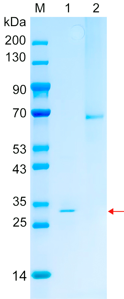 Recombinant YETS4 protein (His tag) SDS-PAGE