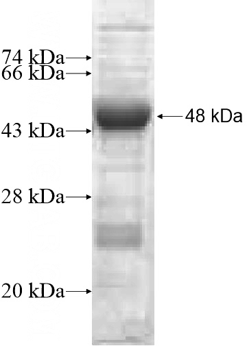 Recombinant Human ARL4D SDS-PAGE